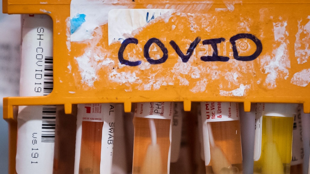 Specimens to be tested for COVID-19 are seen at LifeLabs after being logged upon receipt at the company's lab, in Surrey, B.C., on Thursday, March 26, 2020. (THE CANADIAN PRESS/Darryl Dyck)