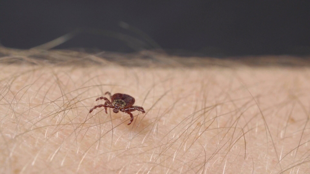 How to keep safe from ticks